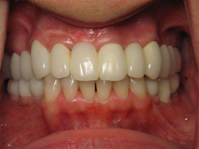 Other views After
