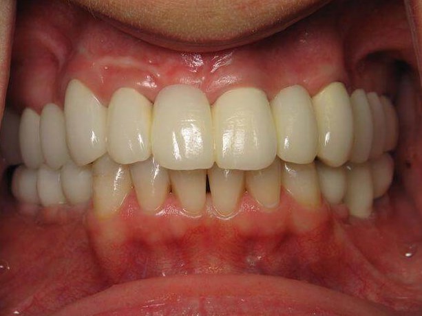 Other views After
