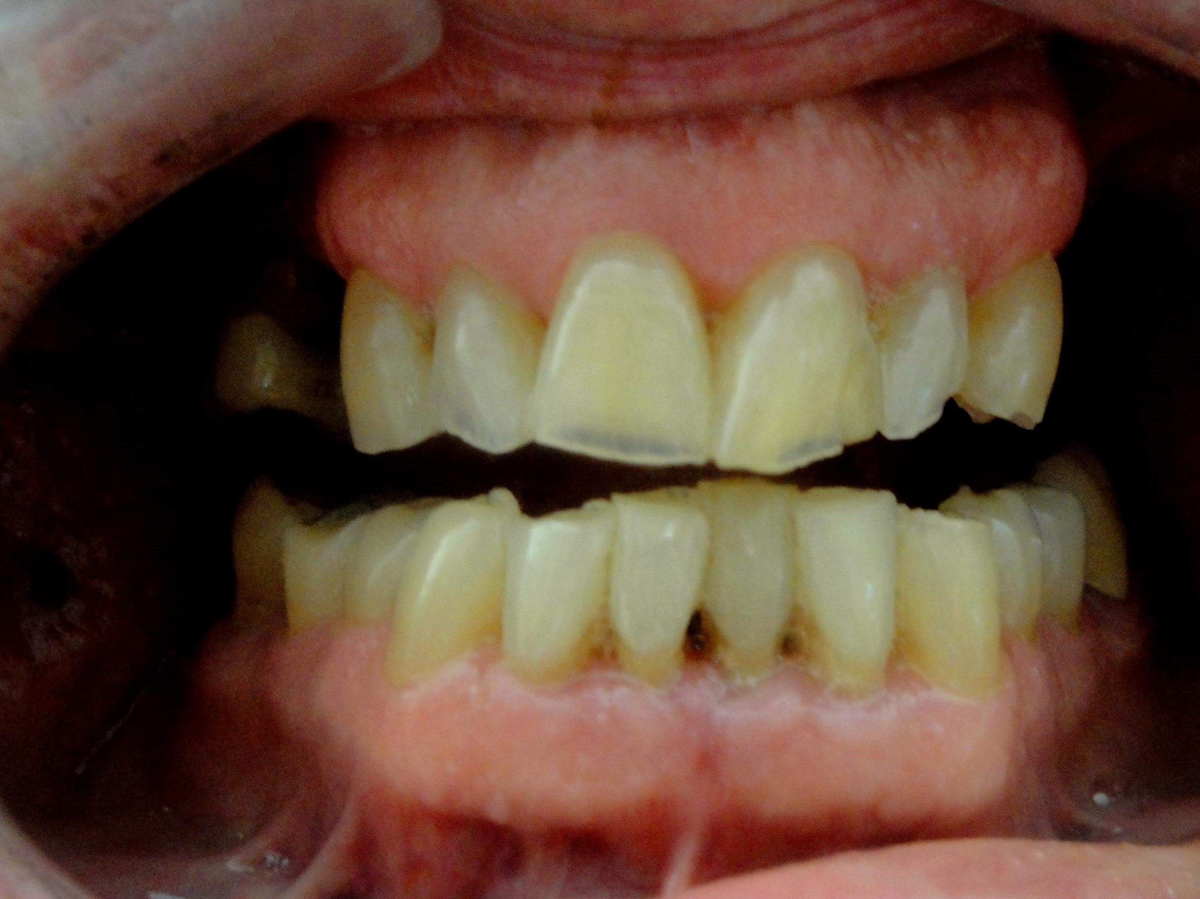 Patient wants his mouth fixed Before