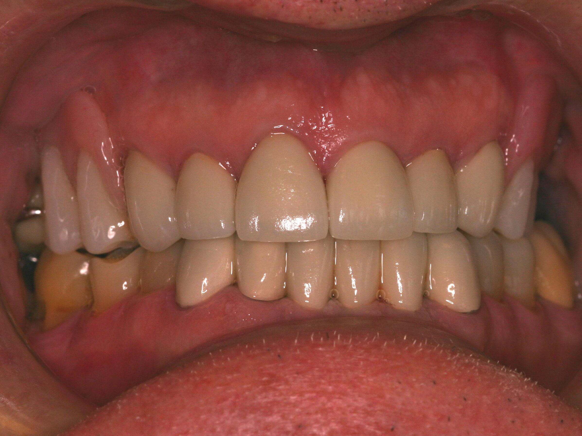 Patient wants his mouth fixed After