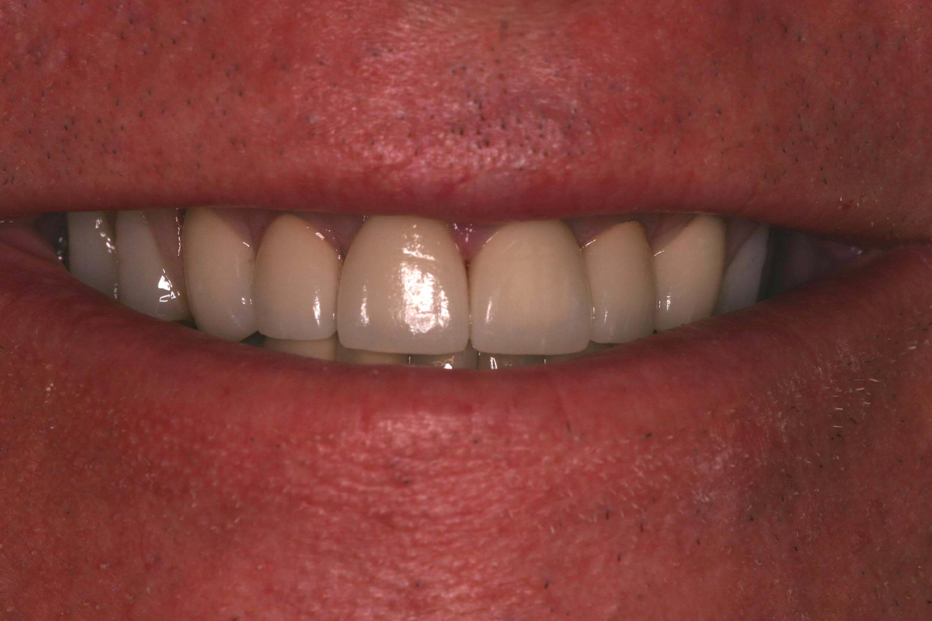 Another view After