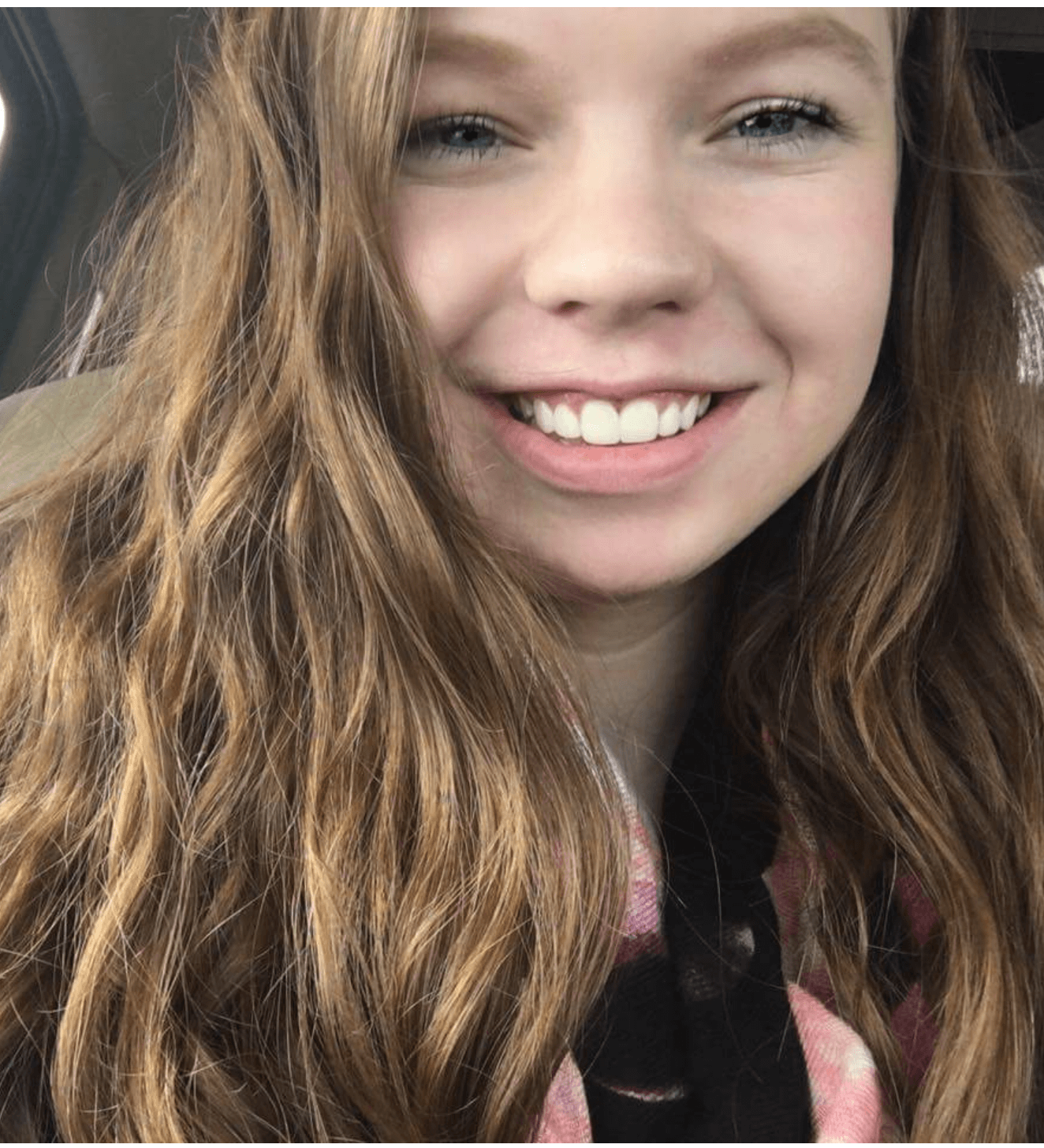 Full Face View After