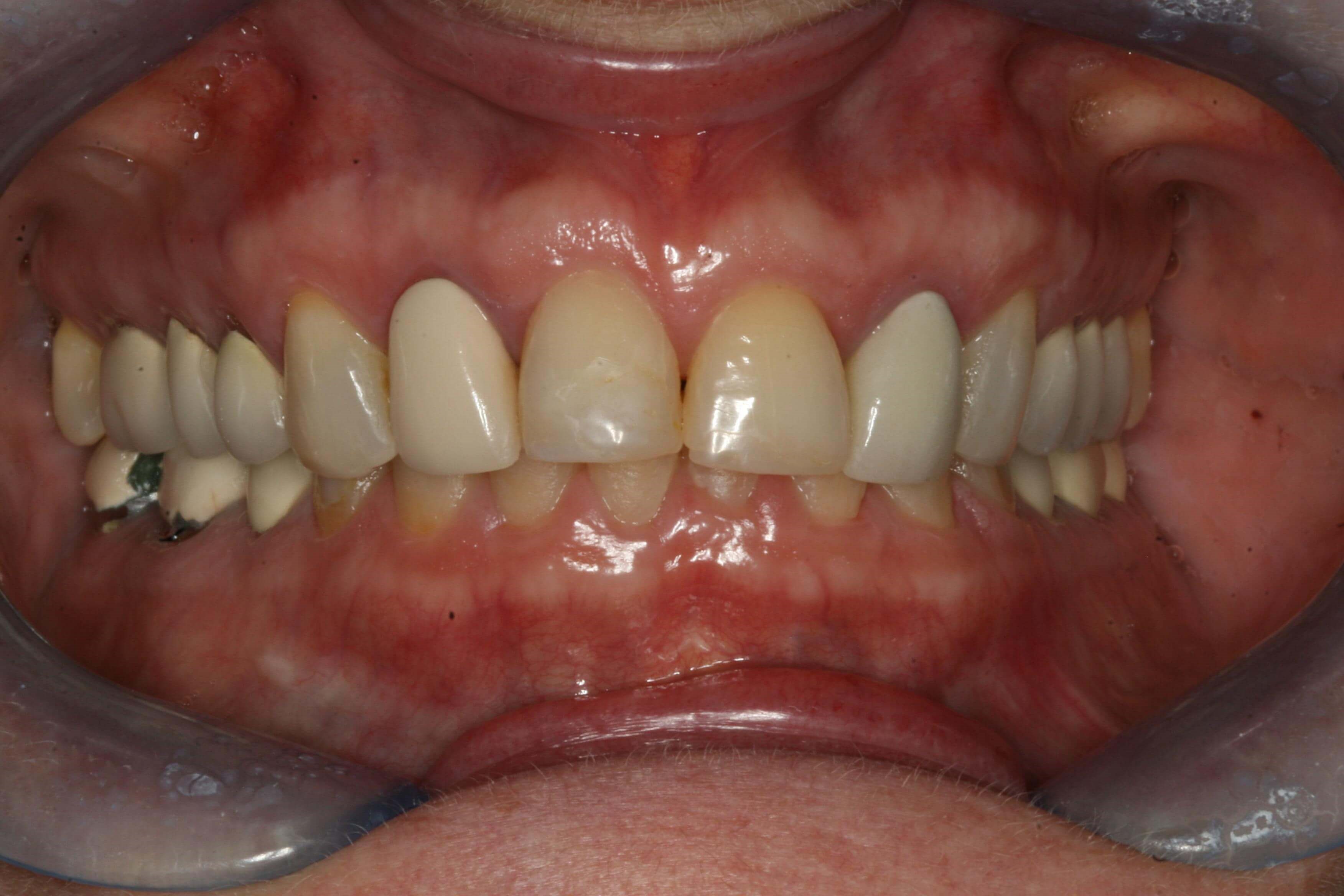 All before pictures Before