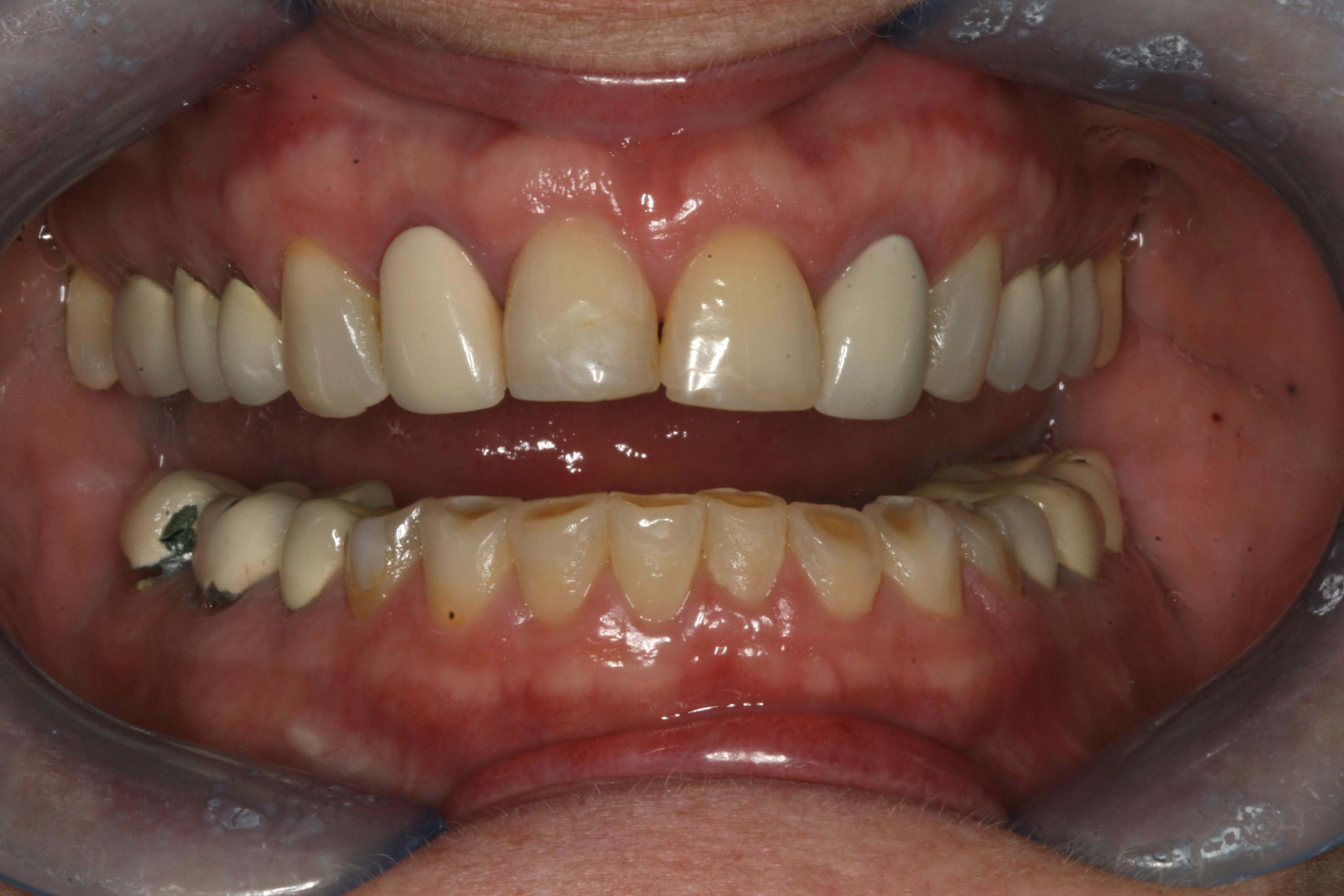 All before pictures Before