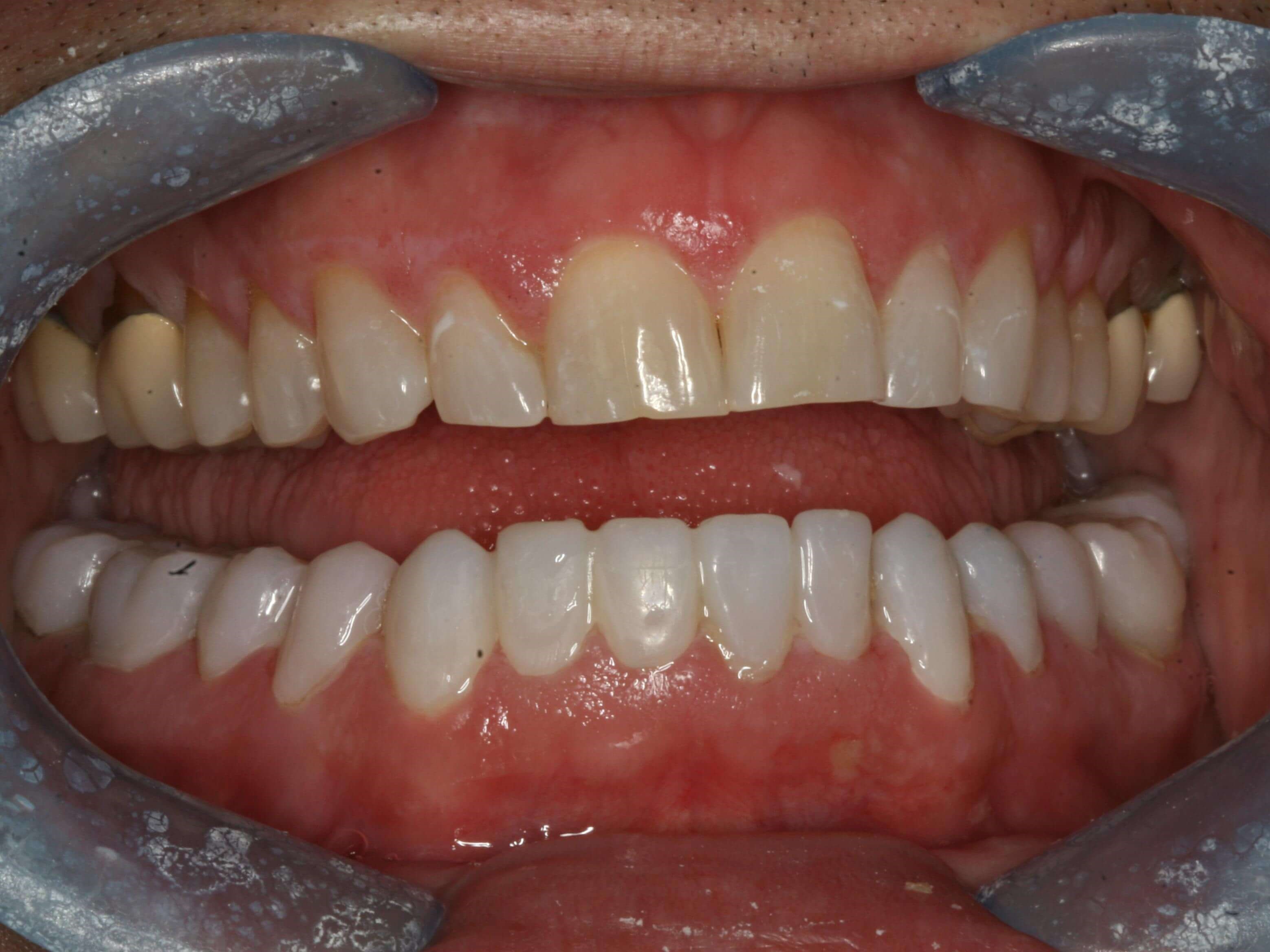 Provisional Photos Temporaries Lower