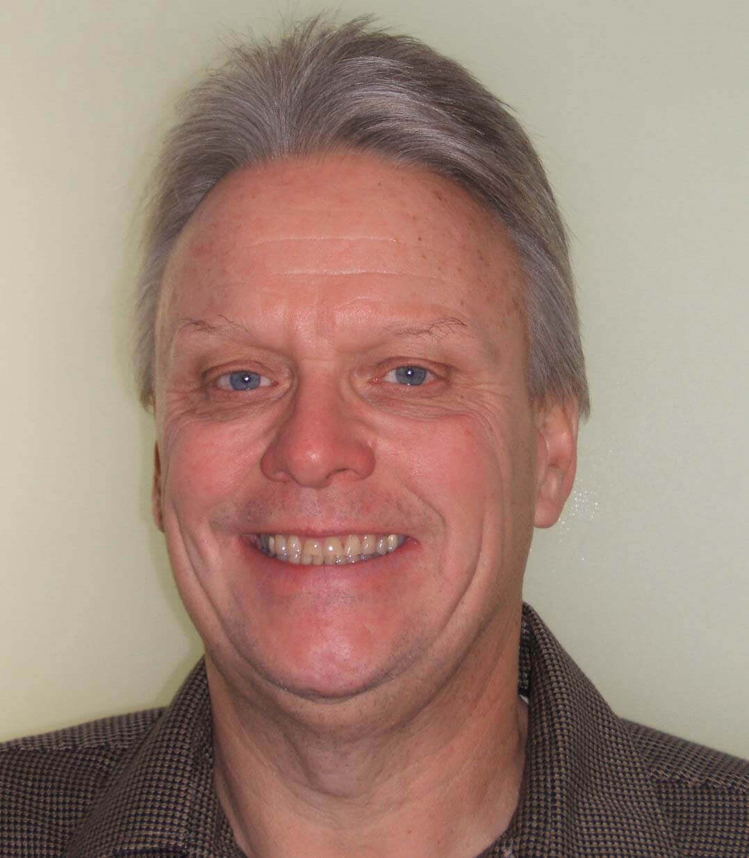 Before And After Smiles Before